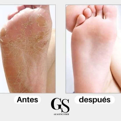 Electric Pedicure Callus Remover® Removedor De Callos Eléctrico Pedicura